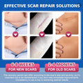 Silicone Scar Sheets,Silicone Scar Tape,Scar Tape For Surgical Scars,C-Section,Tummy Tuck,Keloid Bump Removal (1.6"X 19.7", 3 Rolls-Total 1.5M, Three-In-One Version, Pink/Beige/Clear)