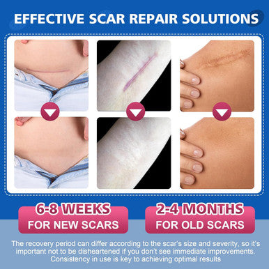 Silicone Scar Sheets,Silicone Scar Tape,Scar Tape For Surgical Scars,C-Section,Tummy Tuck,Keloid Bump Removal (1.6"X 19.7", 3 Rolls-Total 1.5M, Three-In-One Version, Pink/Beige/Clear)