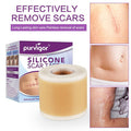 Silicone Scar Tape Roll, 1.6 X 60 Medical Tape For Wound Care Bandages Scars Strips For Surgical Scars Keloid, C-Section, Burns, Injuries Acne, Stretch Marks Removal Sheet Tapes (1.6 X 60 )