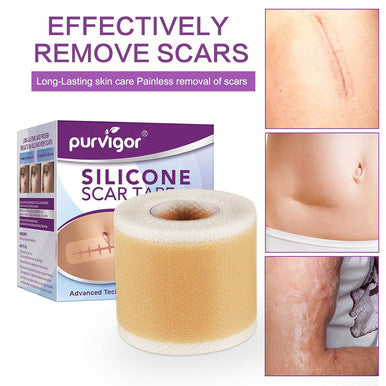 Silicone Scar Tape Roll, 1.6 X 60 Medical Tape For Wound Care Bandages Scars Strips For Surgical Scars Keloid, C-Section, Burns, Injuries Acne, Stretch Marks Removal Sheet Tapes (1.6 X 60 )