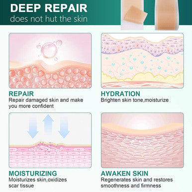 Silicone Scar Sheets,Silicone Scar Tape(1.6"X 60" Roll-1.5M), Reusable And Effective Scar Removal Sheets, Silicone Scar Removal Sheets For Surgical Scars,Healing Keloid, C-Section, Tummy Tuck