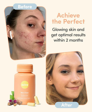 Ovira Skin Clear With Zincbright - 60 Capsules For Clear And Glowing Skin Rosacea & Hormonal Acne Treatment Support Collagen Production Acne Supplements For Women & Men - Pack Of 1