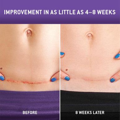 Care Science C Section Recovery Silicone Scar Sheets 1.5In X 7In 8Ct Reuseable Scar Sheets For Reducing The Appearance Of C-Section, Keloid, And Acne Scars