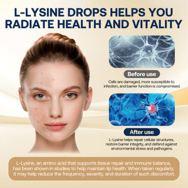 Gz Haoyuan Liposomal L-Lysine 1000Mg Liquid Drops 13-In-1 Lysine Monolaurin Supplements Olive Leaf Extract With Vitamin C B6 D3 B12 & Zinc For Collagen Lip Skin & Immune Support For Kids & Adults 2Oz