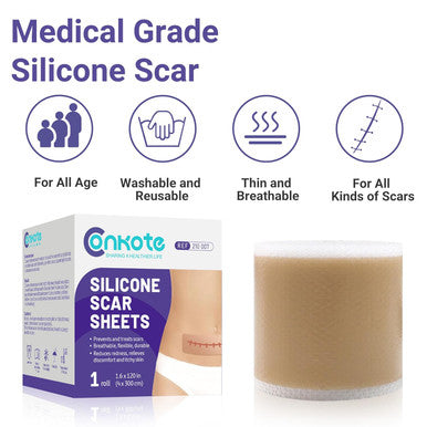 Conkote Silicone Scar Tapes (1.6 X120" Roll-3M), Medical Grade Silicone Scar Sheets, Keloid Bump Removal, Scar Tape For C-Section, Cosmetic Surgical Scars, Stretch Marks, Burn, Acne And Tummy Tuck