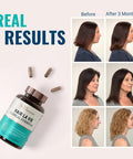 Hair La Vie Live Conscious Clinical Formula Hair Growth Vitamins For Women And Men W/Biotin 5000Mcg, Collagen & Saw Palmetto (Pack Of 1)