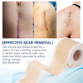 Silicone Scar Sheets (1.6 X 130 , 3.3M), Professional Silicone Scar Tape, Silicone Scar Strips, Reusable Scar Removal Sheets For Surgical Scars, C-Section, Surgery, Burn, Keloid, Acne
