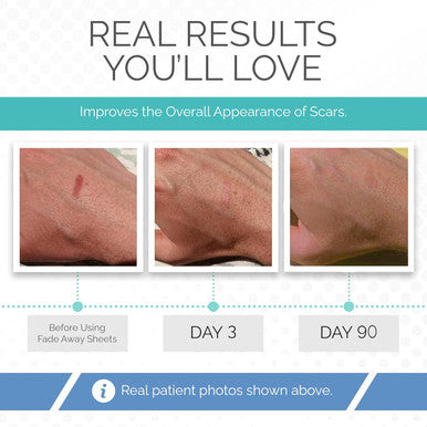Fade Away Scars - The Original Silicone Scar Sheeting Roll- Custom Size Medical Grade- Effective Silicone Scar Sheets, Strips And Patches For Scars, Surgical Scar Tape, Scar Away Silicone Scar Sheets.