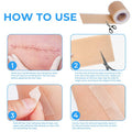 Silicone Scar Sheets, Silicone Scar Tape Roll (60 X1.6 ), Professional Scars Removal Treatment, Scar Silicone Strips, Reusable Silicone Scar Strips Type For Keloid, C-Section, Surgery, Keloid, Acne