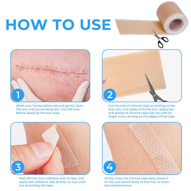 Silicone Scar Sheets, Silicone Scar Tape Roll (60 X1.6 ), Professional Scars Removal Treatment, Scar Silicone Strips, Reusable Silicone Scar Strips Type For Keloid, C-Section, Surgery, Keloid, Acne