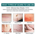 Silicone Scar Sheets (1.6 X 120 Roll-3M), Silicone Scar Tape Roll, Scar Silicone Strips, Reusable, Professional Scar Removal Sheets For C-Section, Surgery, Burn, Keloid, Acne Et