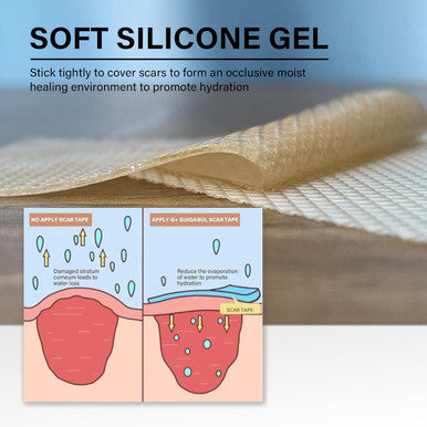 Medical Grade Silicone Scar Tape For Scars Removal - 164" X 1.57" Roll - Silicone Scar Sheets For C-Section, Tummy Tuck, Keloid, And Surgical Scars - Reusable
