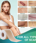 Medical Grade Silicone Scar Sheets, Silicone Scar Tape (1.6 X 120 ), Professional Scar Removal Treatment, Reusable Silicone Scar Strip For Keloid, C-Section, Surgery, Burns, Acne Etc