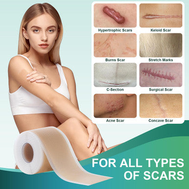 Medical Grade Silicone Scar Sheets, Silicone Scar Tape (1.6 X 120 ), Professional Scar Removal Treatment, Reusable Silicone Scar Strip For Keloid, C-Section, Surgery, Burns, Acne Etc