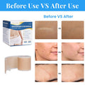Silicone Scar Sheets, Silicone Scar Tape Roll (60 X1.6 ), Professional Scars Removal Treatment, Scar Silicone Strips, Reusable Silicone Scar Strips Type For Keloid, C-Section, Surgery, Keloid, Acne