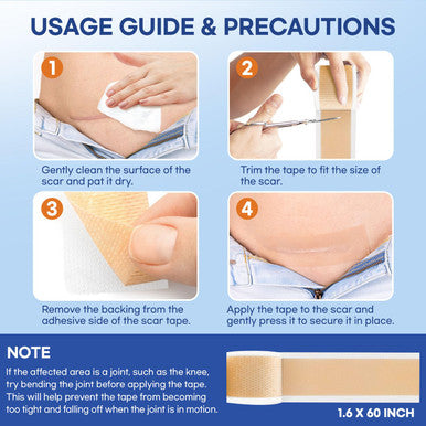 Aroamas Scar Silicone Scar Sheets Silicone Scar Tape 1.6"X60" For Softening And Flattening Scars, C-Section, Keloid, Surgery Reusable & Washable Painless Removal 3-4 Month Supply