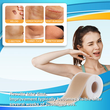 Medical Grade Silicone Scar Tape For Surgical Scars (1.6" X 120" - 3M) Professional Silicone Scar Sheets Scar Treatment For Face Wrinkles, C Section Recovery, Keloid Bump Removal Silicone Scar Patches