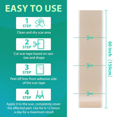 Silicone Scar Sheets, Medical Grade Silicone Scar Tape, Scar Removal Strips For Acne Scars C-Section & Keloid Surgery Scars Sheets Treatment Sheets -1.6"X 60" Roll-1.5M