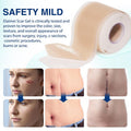 Silicone Scar Sheets (1.6 X 130 , 3.3M), Professional Silicone Scar Tape, Silicone Scar Strips, Reusable Scar Removal Sheets For Surgical Scars, C-Section, Surgery, Burn, Keloid, Acne
