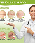Auslka Silicone Scar Sheets(1.6"X 120" Roll-3M), Silicone Scar Tape, Scar Strips, Professional Silicone Scar Tape For C-Section, Tummy Tuck, Keloid, And Scar Patch