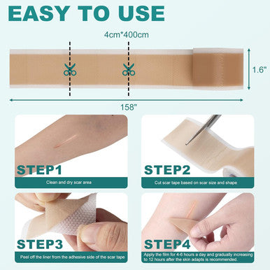 Silicone Scar Sheets, Silicone Scar Tape(1.6"X 158"), Scar Tape For Scar Removal Treatment, Reusable Silicone Scar Strips For Surgical, C-Section, Keloid, Burn, Acne, Surgical Scars