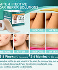 Medical Grade Silicone Scar Sheets, Silicone Scar Tape (1.6 X 120 ), Professional Scar Removal Treatment, Reusable Silicone Scar Strip For Keloid, C-Section, Surgery, Burns, Acne Etc