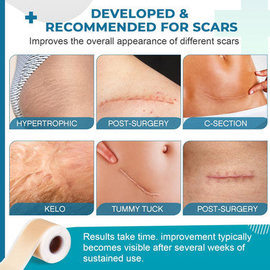 Silicone Scar Sheets, Silicone Scar Tape(1.6 X 60 Roll-1.5M), Silicone Scar Strips, Professional Scar Removal Sheets For Surgical Scars, Keloid, C-Section, Burn Et