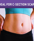 Care Science C Section Recovery Silicone Scar Sheets 1.5In X 7In 8Ct Reuseable Scar Sheets For Reducing The Appearance Of C-Section, Keloid, And Acne Scars