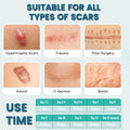 Silicone Scar Sheets (2 Rolls), Medical Grade Silicone Scar Tape, Scar Removal Strips For Acne, Burn Scars C-Section & Keloid Surgery Scars Sheets Treatment Sheets - 8 Month Supply