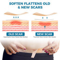 Scar Away Silicone Scar Sheets, Silicone Scar Tape (1.6 X 120 Roll), Scar Removal Sheets, Scar Strips For Surgical Scars, Stretch Marks, C-Section, Keloid, Tummy Tuck, Burn, Old/Scars, Reusable