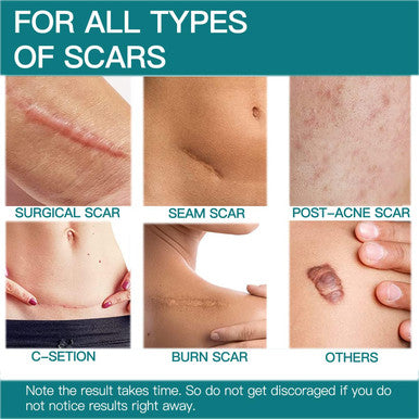 Silicone Scar Sheets (1.6" X 120"- 3 Meter), Medical Grade Silicone Scar Tape, Scar Removal Strips For Acne, Burn Scars C-Section & Keloid Surgery Scars Sheets Treatment Sheets