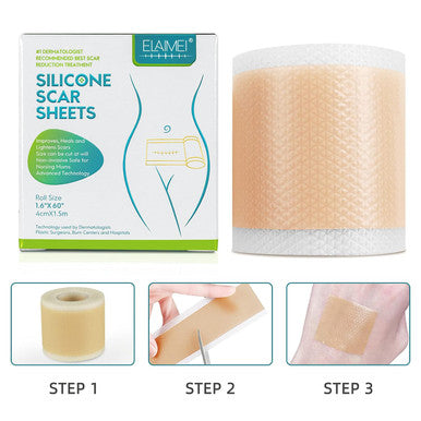 Medical Grade Silicone Scar Sheets, Silicone Scar Tape (1.6 X 60 ), Scar Removal Strips For Acne Scars C-Section & Keloid Surgery Scars Sheets Treatment Sheets - 6-8 Month Supply