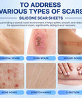 Aroamas Scar Silicone Scar Sheets Silicone Scar Tape 1.6"X60" For Softening And Flattening Scars, C-Section, Keloid, Surgery Reusable & Washable Painless Removal 3-4 Month Supply