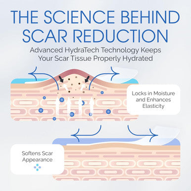 Advanced Scar Treatment - Medical Grade Silicone Scar Sheets, Long Water-Resistant Silicone Scar Tapes For Surgical Scars, Stretch Marks, Keloid Bump - 7 Inch, 12 Strips