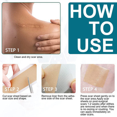 Scar Silicone Scar Sheets, Tape, Strips Healing Keloid, C-Section, Tummy, Tuck Stretching Mark As Surgical Cream, Gel, Patch,Pad Surgery Scars Treatment 4 Pack 5.7"X1.57" (6 Count)