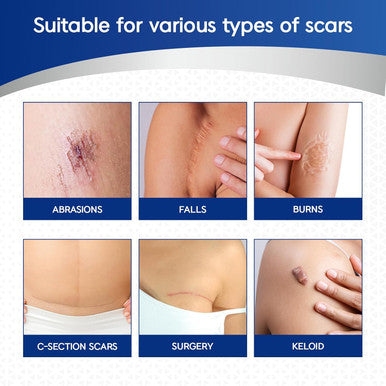 Murasaki Beauty Silicone Scar Tape & Sheets Removal On Keloids, Burns, Abrasion, C-Section, And Surgical Scars Safe For Adults And Children 1.6"X 60" Roll-4 X 1.5M(Pack Of 1) (1.6X60Inch)