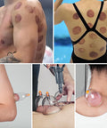 Ditind Cupping Therapy Set, 18 Pcs Cupping Set, Professional Cupping Kit For Massage Therapy, Portable Cupping With Case, Pump Suction Cups For Cellulite Muscle Pain Relief Physical Therapy.