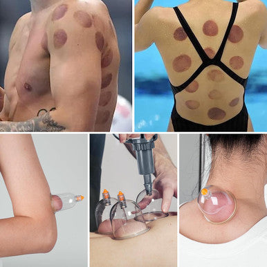 Ditind Cupping Therapy Set, 18 Pcs Cupping Set, Professional Cupping Kit For Massage Therapy, Portable Cupping With Case, Pump Suction Cups For Cellulite Muscle Pain Relief Physical Therapy.