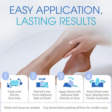 Advanced Scar Treatment - Medical Grade Silicone Scar Sheets, Long Water-Resistant Silicone Scar Tapes For Surgical Scars, Stretch Marks, Keloid Bump - 7 Inch, 12 Strips