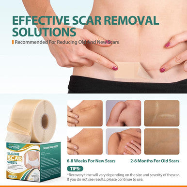 Geloo Professional Silicone Scar Sheets (Roll 1.6 160"- 4.06M) - Extended Edition Silicone Scar Tapes - Reusable Scar Removal Silicone Gel Strips For C-Section, Keloid, Surgery, Burn Scar Etc