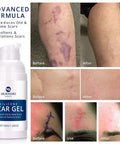 100% Silicone Scar Gel Scar Cream - Advanced Scar Gel For Surgical Scars, C-Section, Stretch Marks, Acne, Injury, Burns, Keloids, Old And Scars 1.06Oz(30G) (Maximum Strength 100% Silicone)