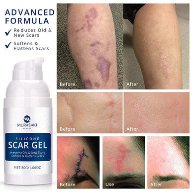 100% Silicone Scar Gel Scar Cream - Advanced Scar Gel For Surgical Scars, C-Section, Stretch Marks, Acne, Injury, Burns, Keloids, Old And Scars 1.06Oz(30G) (Maximum Strength 100% Silicone)