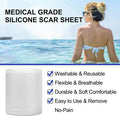 Silicone Scar Sheets (1.6 X 120 ), Clear Gel Silicone Scar Tape, Invisible Medical Grade Scar Silicone Strips, Transparent Advanced Removal Scar Patches For C-Section, Keloids, Burn, Acne
