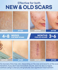 Aroamas Scar Silicone Scar Sheets Silicone Scar Tape 1.6"X60" For Softening And Flattening Scars, C-Section, Keloid, Surgery Reusable & Washable Painless Removal 3-4 Month Supply