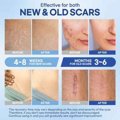 Aroamas Scar Silicone Scar Sheets Silicone Scar Tape 1.6"X60" For Softening And Flattening Scars, C-Section, Keloid, Surgery Reusable & Washable Painless Removal 3-4 Month Supply