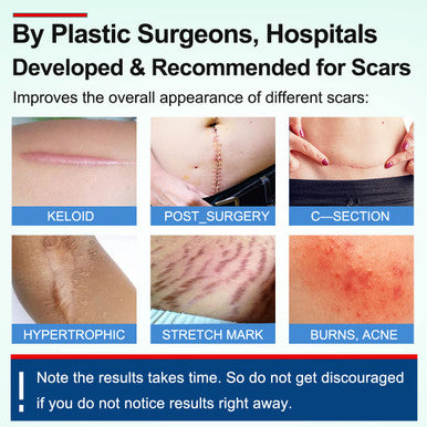 Silicone Scar Sheets, Silicone Scar Tape, Scar Sheet For Surgical Scars, C Section Scar Silicone Strips, Medical Grade, Reusable, Soften And Flattens Scars, Breast, Keloid, Professional Scar Patches.