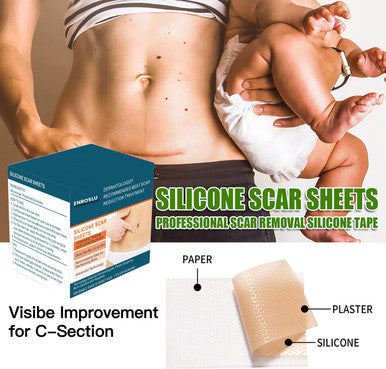 Silicone Scar Sheets (1.6" X 120"- 3 Meter), Medical Grade Silicone Scar Tape, Scar Removal Strips For Acne, Burn Scars C-Section & Keloid Surgery Scars Sheets Treatment Sheets