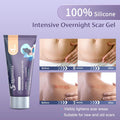 Pm Intensive Overnight Scar Cream 1.06 Oz, Medical Grade Silicone Scar Gel, Promotes Skin Regeneration When You Sleep, Scar Treatment Cream From Surgery, Injuries, Burns, Keloids, Etc