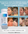 Clearstem - Mindbodyskin Hormonal Acne Supplement (5-Htp) - Natural Dim Supplement - Skin Care Vitamins - Hormone Balance, Antioxidants - Vegan, Gluten Free, Cruelty - 30 Servings, 90 Capsules