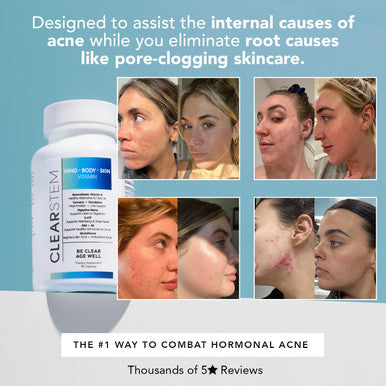 Clearstem - Mindbodyskin Hormonal Acne Supplement (5-Htp) - Natural Dim Supplement - Skin Care Vitamins - Hormone Balance, Antioxidants - Vegan, Gluten Free, Cruelty - 30 Servings, 90 Capsules